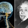 脳の重さは関係ナシ “東大脳”と“ボンクラ脳”の違いはココ