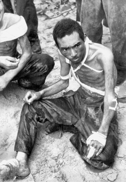 骨と皮だけになり、米軍に捕らえられた日本兵（１９４３年２月、ガダルカナル島）／（Ｃ）共同通信社