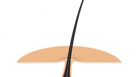 育毛剤「ニューモ」が大ヒット中「ファーマフーズ」に勝機