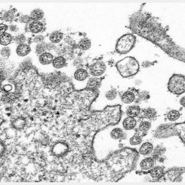 新型コロナウイルスの出現は何を意味するのか（Ｃ）ロイター