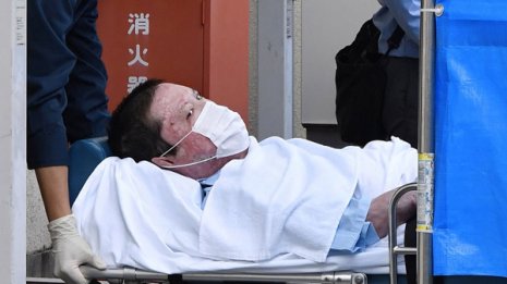 京アニ放火犯を救った1000万円の治療費 誰が負担するのか