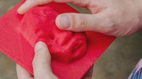 視覚障がいの母、妊娠中のわが子の顔を3Dプリンターで確認