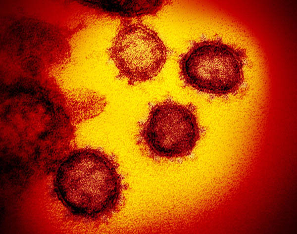 新型コロナウイルスの顕微鏡写真（米国立アレルギー感染症研究所提供）