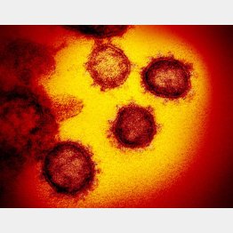 新型コロナウイルスの顕微鏡写真（米国立アレルギー感染症研究所提供）