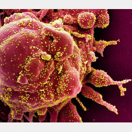 どんどん変異していく…（SARS-COV-2ウイルスのかけら≪黄≫に染まるアポトーシス細胞≪赤≫の電子顕微鏡写真）／（Ｃ）ロイター