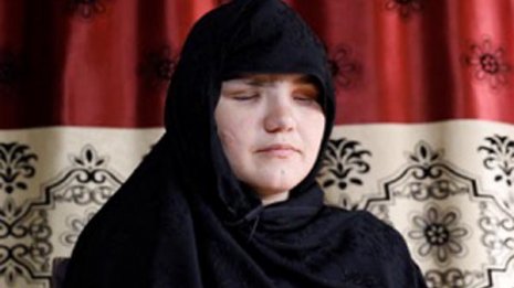 タリバンの蛮行を忘れない！ 拷問から生き延びアフガニスタンを脱出した女性の訴え