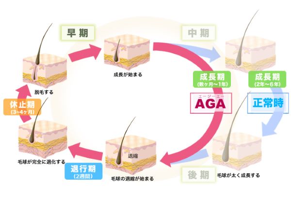 AGAのサイクル