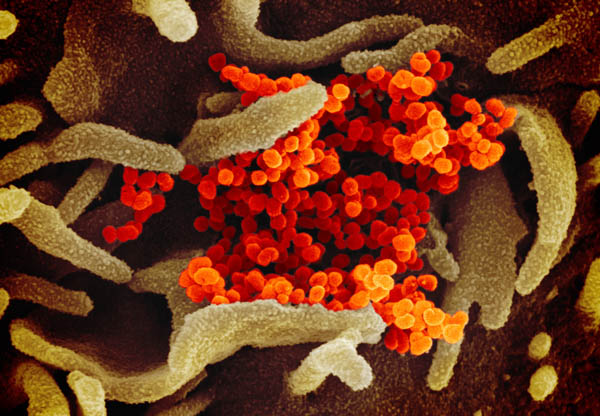 新型コロナウイルス SARS-CoV-2の顕微鏡イメージ（Ｃ）IMAGEPOINTFR=LPN／ニューズコム／共同通信イメージズ