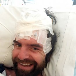 謎の黒カビに脳内を侵され…35歳米国男性「この菌で苦しんでいるのは自分だけ」