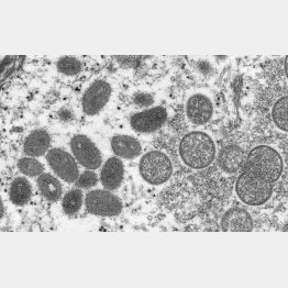 まだまだ広がるのか（サル痘ウイルスの顕微鏡写真＝CDC提供・共同）