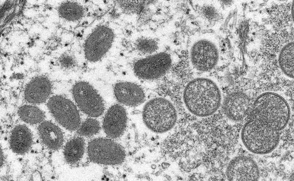 サル痘ウイルスの顕微鏡写真（CDC提供・共同）