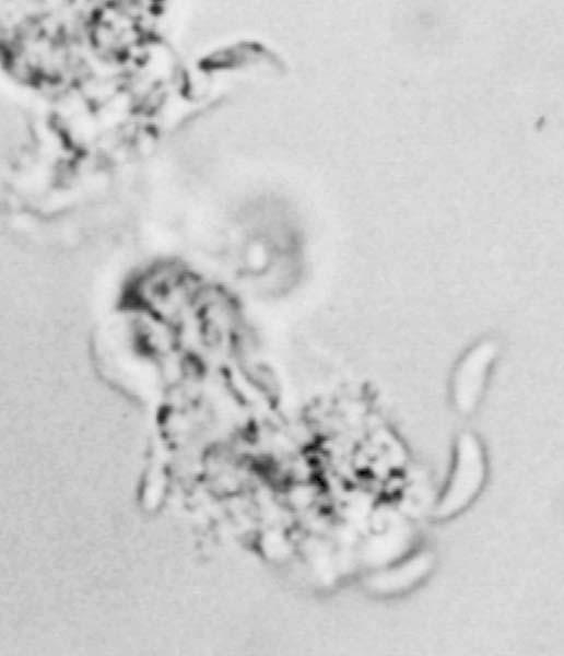 ヒトの脳せき髄液から見つかったトキソプラズマ原虫（右下の米粒状の3個）／（Ｃ）共同通信社