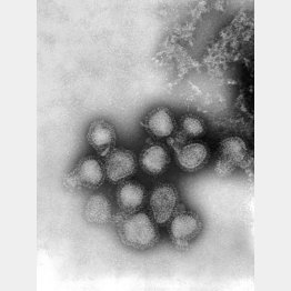Ａ香港型インフルエンザウイルスの顕微鏡写真（米疾病対策センター提供）