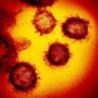 新型コロナウイルスは致死率9％のSARSと何が違うのか？