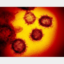 世界中で猛威を振るう新型コロナウイルス（米国立アレルギー感染症研究所提供）