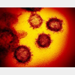 新型コロナウイルスの電子顕微鏡拡大写真（米国立アレルギー感染症研究所提供）