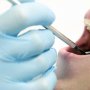 コロナ禍の受診控えで歯周病を悪化させる人が急増している
