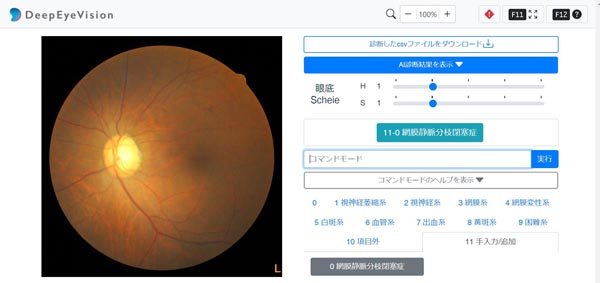 「眼科向け画像AI診断支援サービス」／（提供写真）