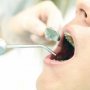 糖尿病の人は歯の喪失リスクが高…「歯を守るためのポイント」