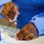 サル痘改め「エムポックス」 日本でワクチンの臨床研究がスタート