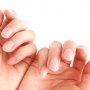 糖尿病網膜症は「爪検査」で見つけられる？ 東北大大学院の研究チームが公表