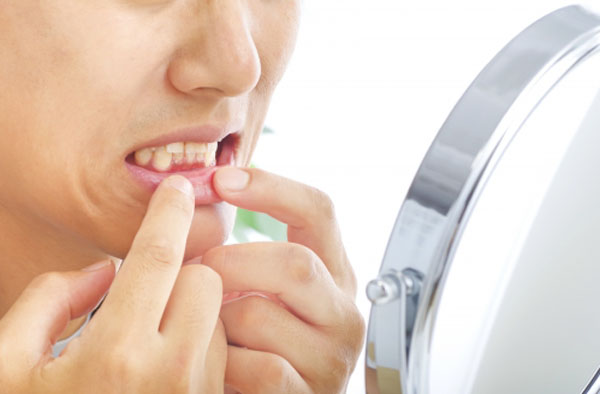 白い歯を維持している人は自己管理ができていて信頼できるイメージが