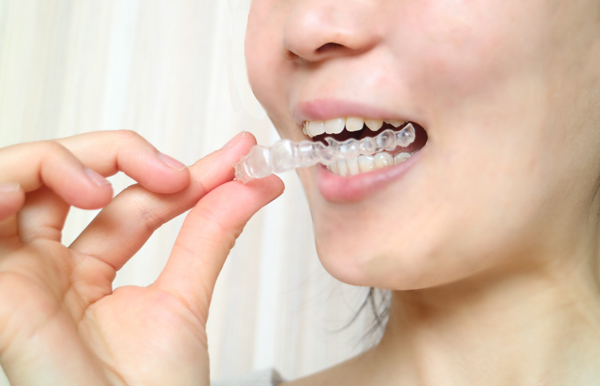 マウスピースは歯の摩耗や欠けるのを防ぐために効果的