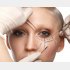 思い切って整形（写真:iStock）