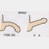 陰茎湾曲症の術前術後の図：陰茎湾曲症の治療前（左）と治療後（右）永尾光一氏提供