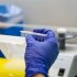 検査で薬剤の探索が可能になる（写真はイメージ）／（Ｃ）iStock